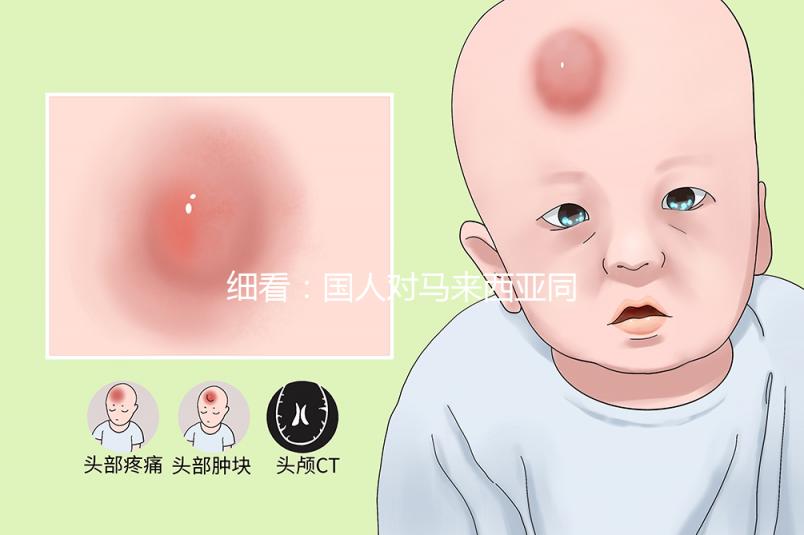 細(xì)看:國(guó)人對(duì)馬來(lái)西亞同善醫(yī)院試管嬰兒技術(shù)的評(píng)價(jià)