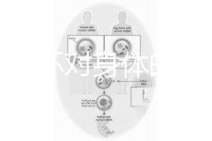 揭秘上環(huán)對(duì)身體的5大壞處,女人別再無知了