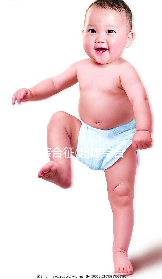 XXX綜合征(超雌綜合征)是什么?一種性染色體異常的疾病