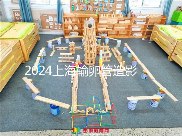 2024上海輸卵管造影檢查多少錢速覽，關(guān)鍵看能否報銷